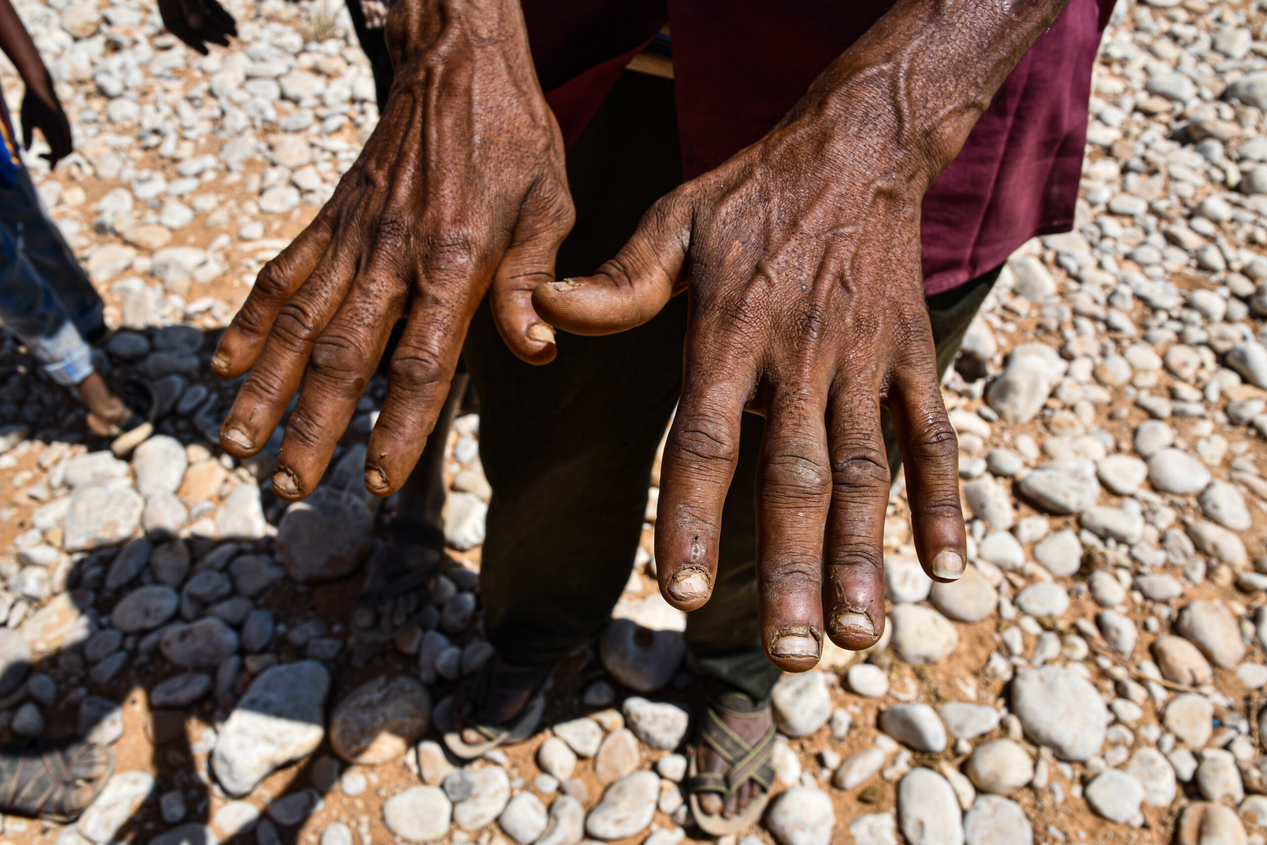 Ucraina: la guerra produce fame in Corno d'Africa