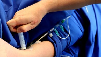 Photo of Alghero Terapia e limiti terapeutici nel dolore cronico