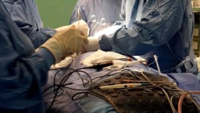 Photo of Gli otorini festeggiano San Biagio